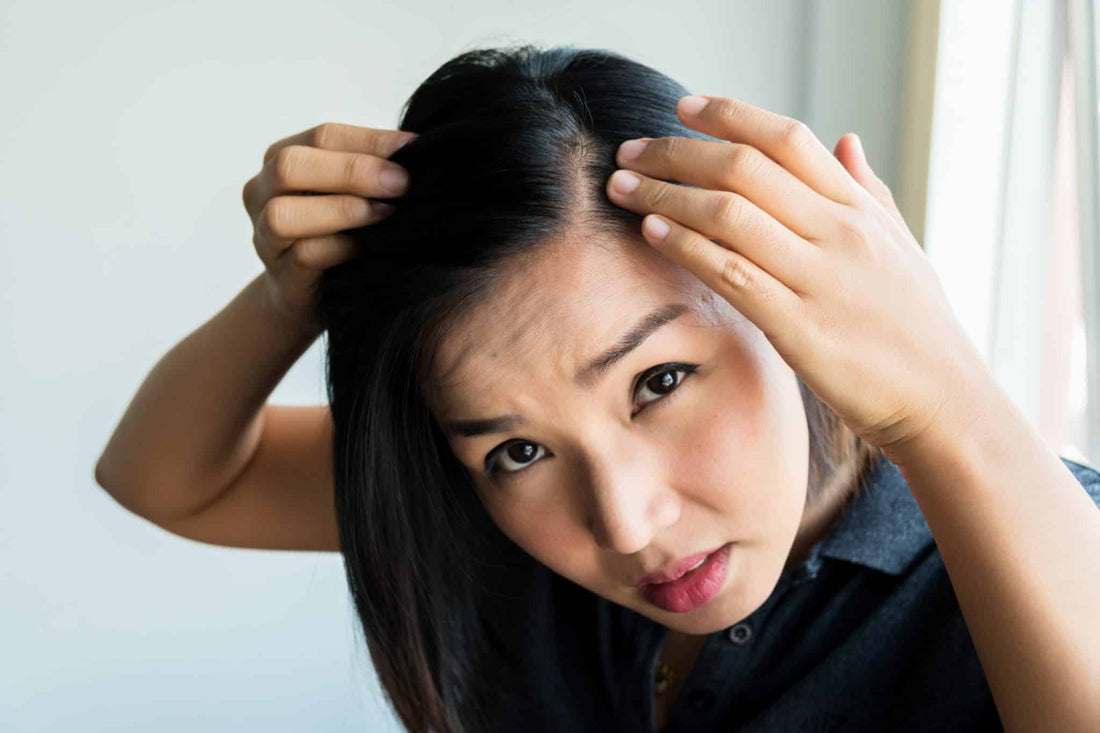 5 Treatments To Prevent And Treat Hair Loss In Singapore - TrichoLab