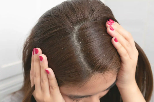 Are You Using Anti-Dandruff Shampoo Wrongly?