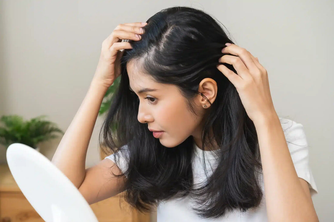Is Stress Secretly Making Your Dandruff Worse?