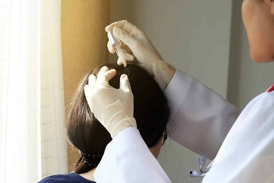 Scalp Treatment In Singapore: How To Choose A Scalp Specialist