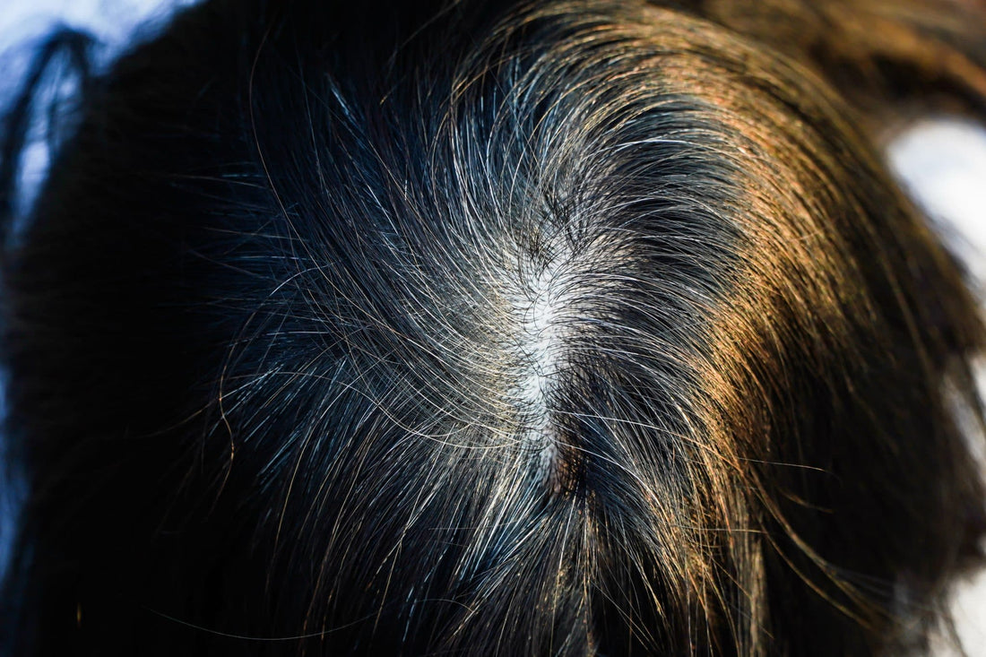 What Causes Grey Hair at an Early Age? - TrichoLab