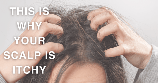 Why you should not ignore an itchy scalp