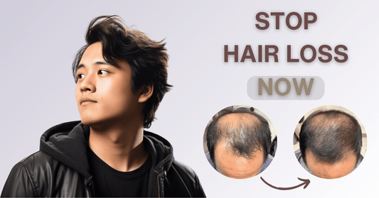 5 signs your hair loss needs attention