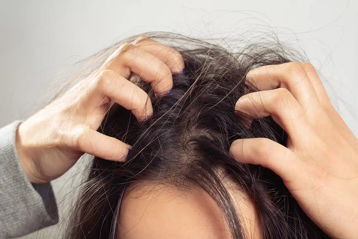 Close-up of a red, reactive scalp